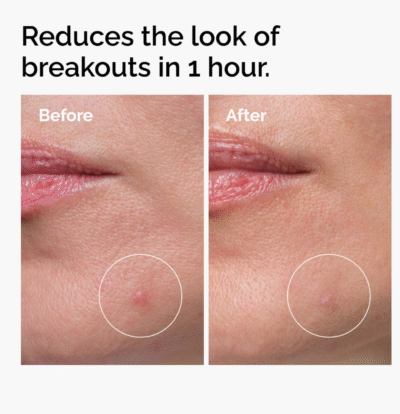 Poudre souffre 10% anti imperfection - The Ordinary – Image 3