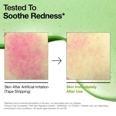 Sérum anti rougeur acide azélaique - Anua – Image 2